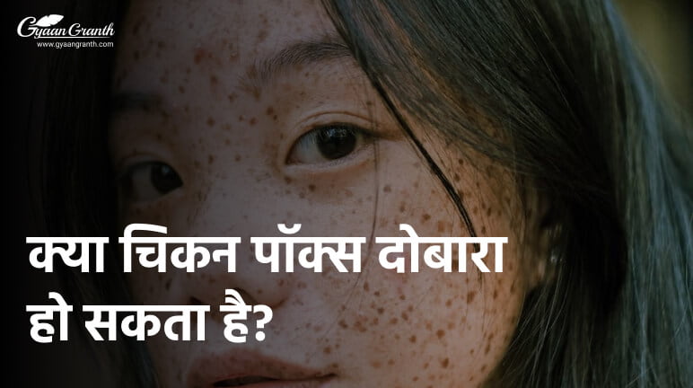 क्या चिकन पॉक्स दोबारा हो सकता है?