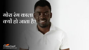 गोरा रंग काला क्यों हो जाता है